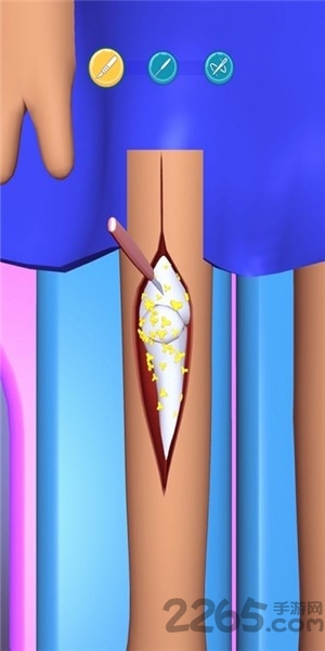 外科手术大师破解版(surgery master)